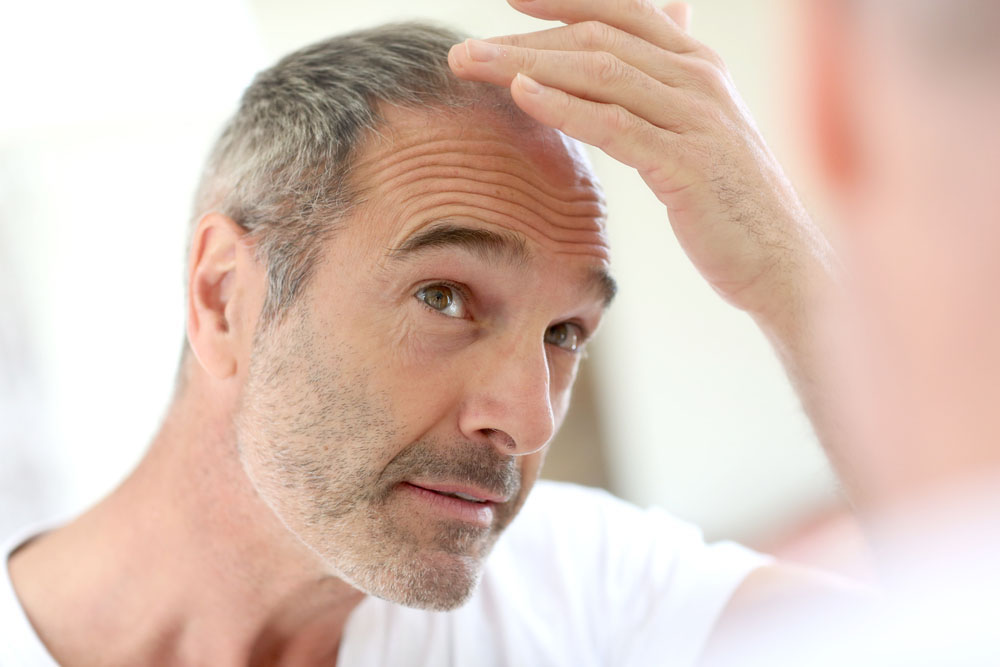 Hombre viejo con perdida de cabello